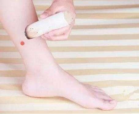 艾灸 除了男人以外女性最好的生活伴侣