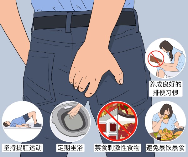 痔疮注意事项及饮食禁忌.jpg