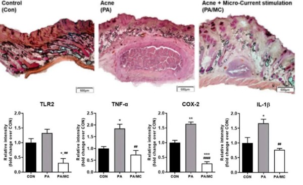 BIOCELLINE电子皮肤：微电场怎样实现“导入+修复+抗炎+抗衰”？