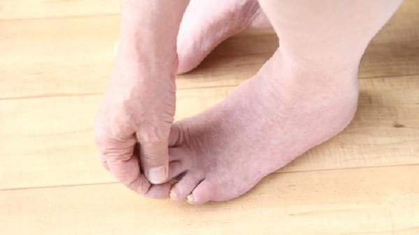脚蜕皮但是不痒是什么原因? 脚底脱皮是什么问题?