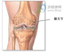 治风湿 饮食疗法全攻略