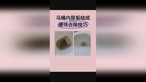 清理马桶尿垢用什么最好？无刷洗去除马桶内尿垢黄垢结石的办法！