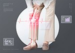 骨质疏松医疗海报4