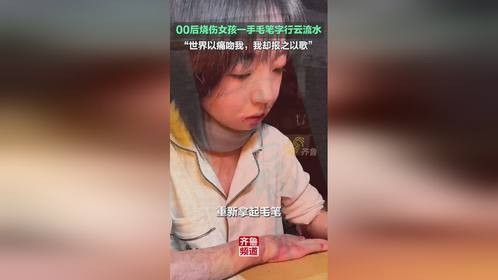 00后烧伤女孩一手毛笔字行云流水，世界以痛吻我，我却报之以歌