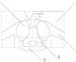 一种肺部呼吸运动立体机构的制作方法