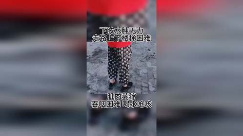 上下楼梯困难，走路摇晃不稳