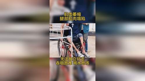 四肢无力萎缩，共济失调