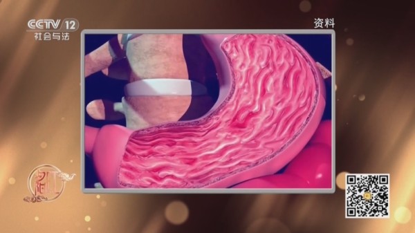 《夕阳红》 20250415 癌变迷局——胃癌危机是如何引爆的？