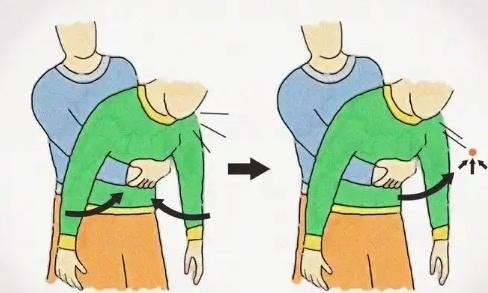日常医用小知识 常见的家庭急救知识