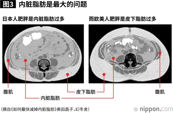 腹部的横断面照片。上为肚脐，下为后背。