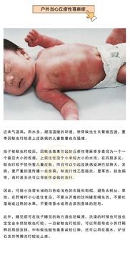 运动后需要立即清洁皮肤吗