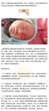 运动后需要立即清洁皮肤吗