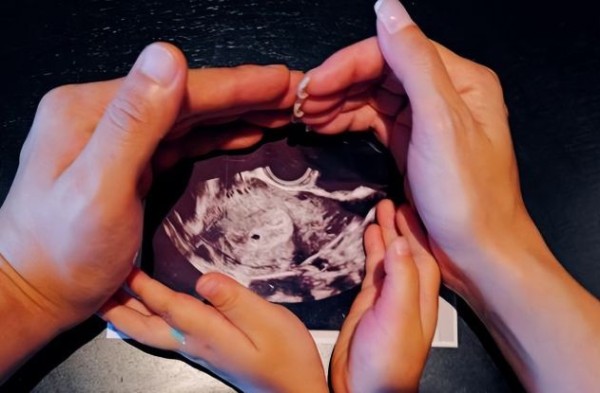 韩庚老婆挺二胎孕肚练瑜伽 孕期逆生长典范