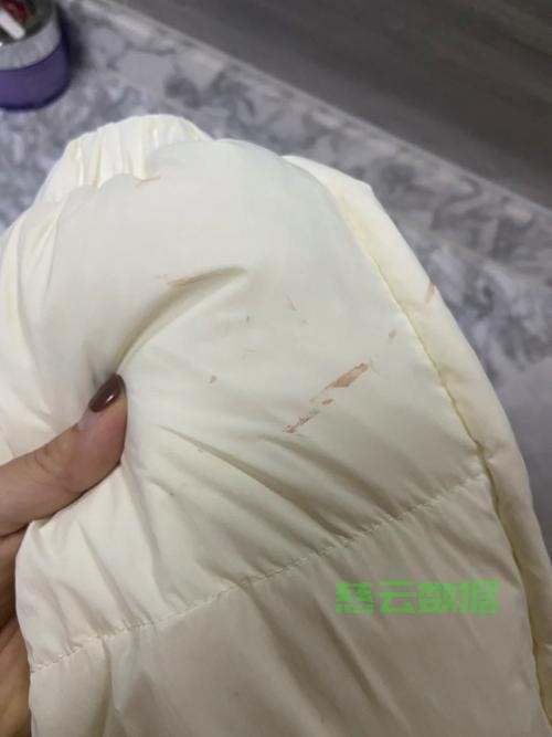 揭秘去血渍秘籍，衣物顽固血渍轻松清除小妙招 第3张