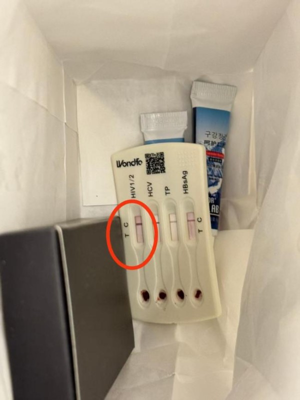 酒店洗漱包内发现用过的HIV检测盒