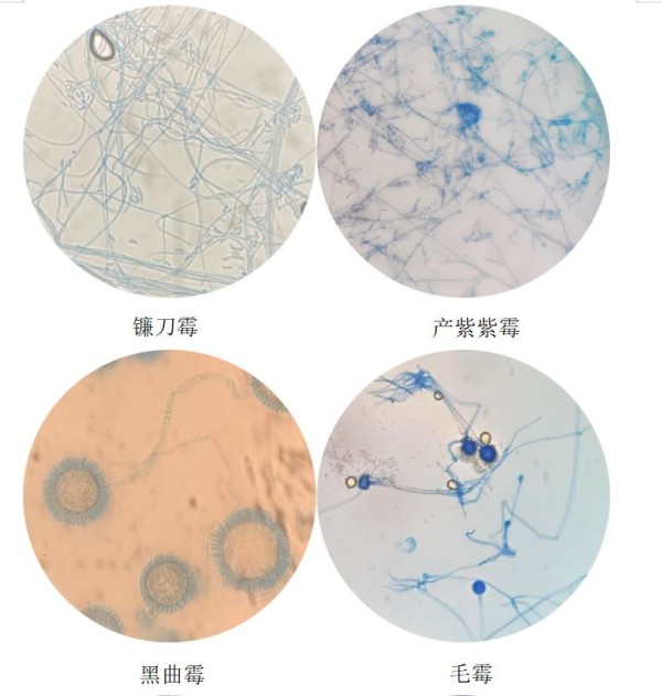 霉菌8.JPG