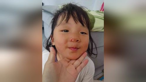 女孩一眨眼功夫将珠子塞鼻孔里，家里有这种玩具的家长要注意