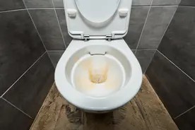 马桶黄垢和异味反复?手把手教你清洁妙招,洗完马桶干净又卫生!图片