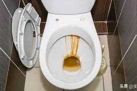 往马桶里撒一把,不管多脏多厚的黄渍,水一冲就干净,省钱又实用图片