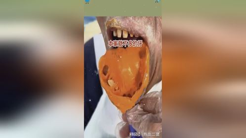 本家就不多的牙，现在更加雪上加霜