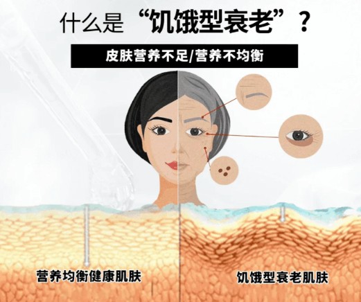 饮食不均衡的危害,你的身体正在发出警告信号!插图