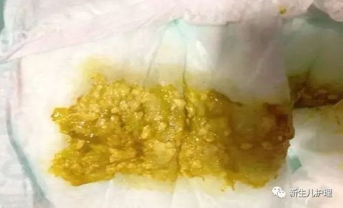 狗喝牛奶后拉肚子:紧急应对指南
