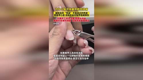 为什么每次做美甲都觉得痛，被除去的“死皮”，不是真正的死皮，而是甲小皮，去除后会对指甲造成损伤#美甲