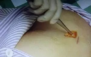 53201661832170933