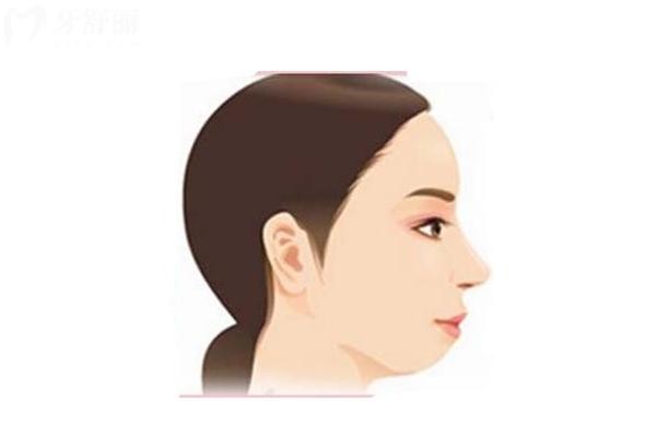 下巴后缩是什么原因？如何改善？通过矫正或日常习惯改变可改善