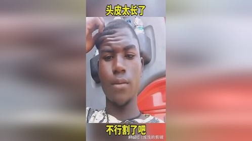 头皮太长了，不行割了吧！