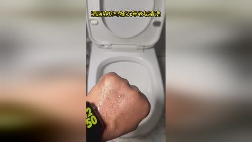 酒店客房的马桶有坚硬的沉年老垢实测苦安酸洗清除马桶重度结垢