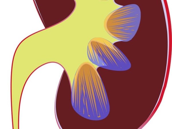 尿酸高别慌科学饮食加运动可逆转