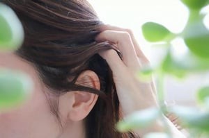 女性头发稀疏的图片