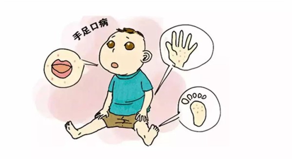 【卫生保健】幼儿园秋季传染病的预防小贴士-幼师课件网第2张图片