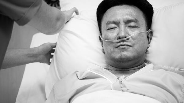 下颌角后缩禁忌人群与术后护理