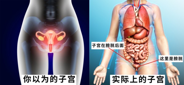 “妇癌之王”卵巢癌大揭秘：早期没症状，这些人高危