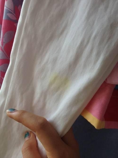 生活小常识：白色衣物发黄难清洗怎么办？
