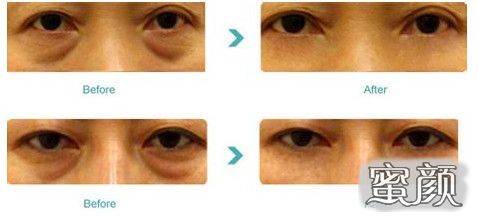 https://img.yuejiaxmz.com/upload/2025/0923/20250923194503_0_u023v6nk.jpg