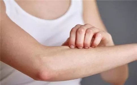 李时珍养生堂：皮肤过敏怎么办？6个妙招教你防治
