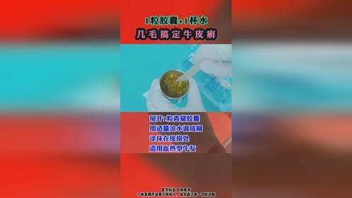 用这个方法几毛搞定牛皮癣靠谱吗