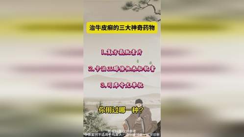治疗牛皮癣的三大神奇药物那你用过吗