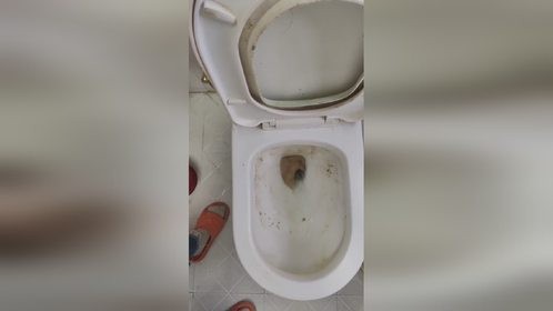 马桶s弯石头一样的尿垢结石尿碱无刷洗溶解去除过程