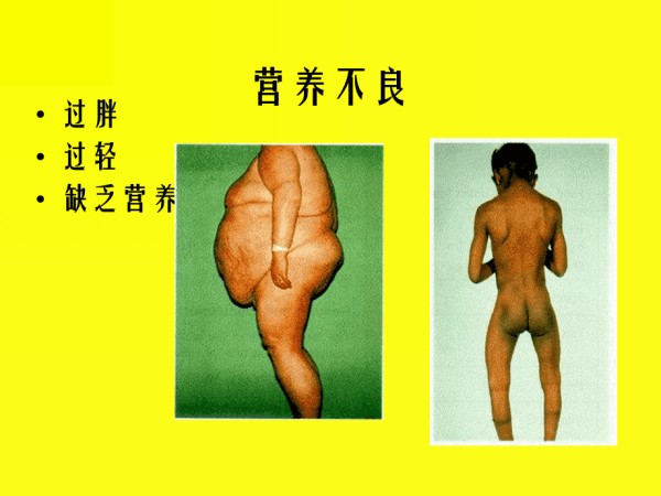 健康饮食全面均衡适量.ppt_第3页