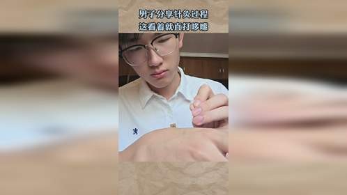男子分享针灸过程，这看着就直打哆嗦