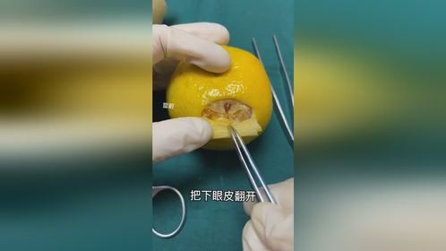 用阴影粉遮眼袋管用不？