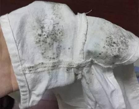 衣服发霉不能穿,6招还你干净清新衣物