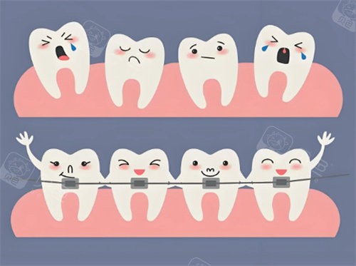 牙齿矫正卡通展示
