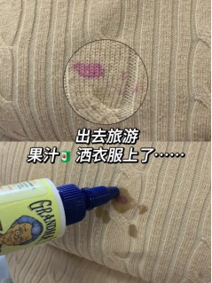 衣服沾油不用愁,这个去渍小妙招省时又省力