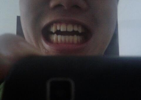 不要问我,为什么我的犬牙啦么尖~