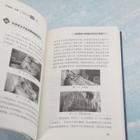 [醉染正版]肝移植·真相——患者必读的100个问题 叶海丹 编 家庭保健 生活 清华大学出版社 美术